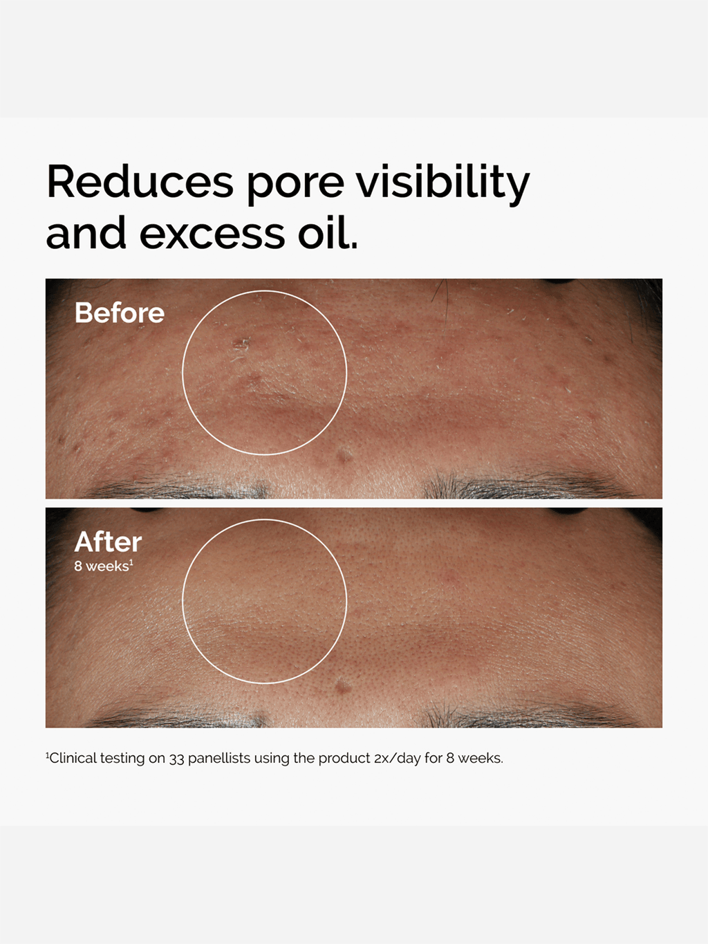 Ordinary Niacinamide 10% + Zinc 1%