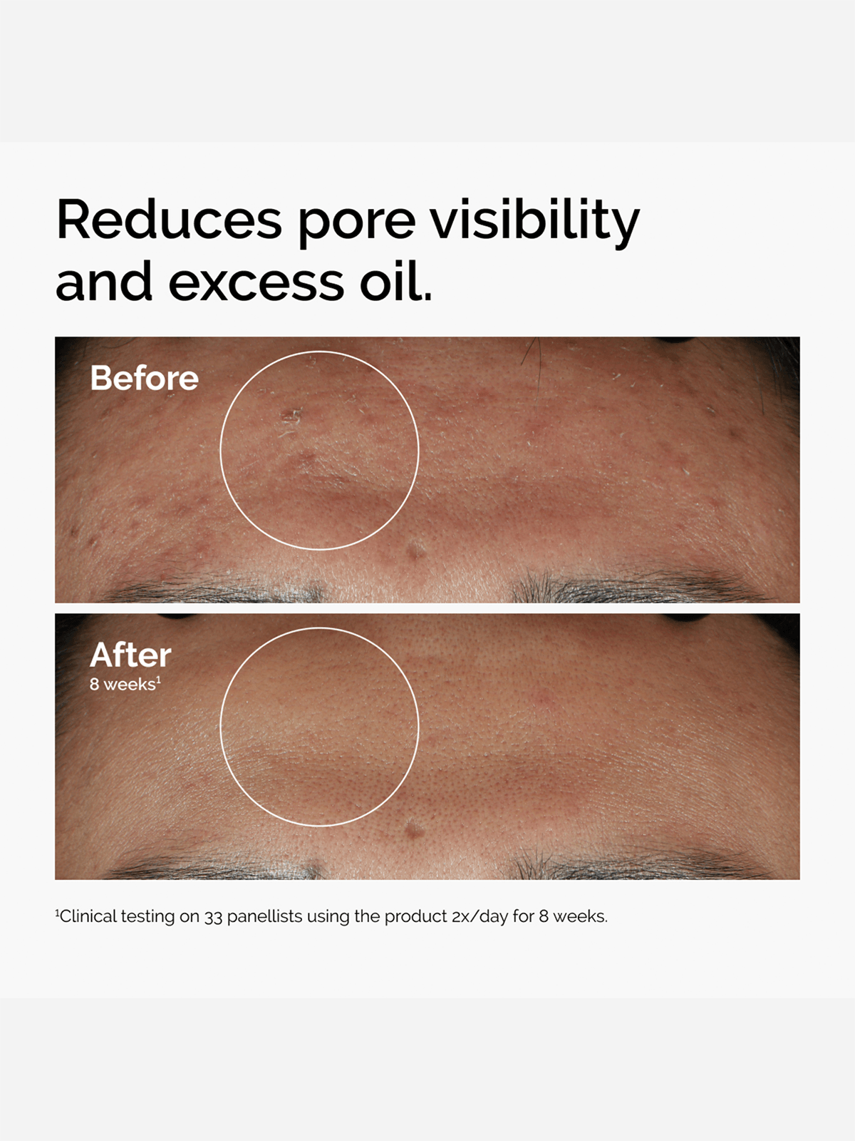 Ordinary Niacinamide 10% + Zinc 1%